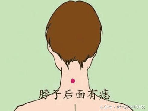痣相圖解:女人脖子上有痣圖解